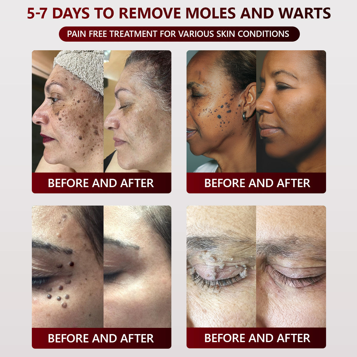 👑Dermatology Department Recommendation👑 Healrize® 𝐁𝐥𝗮𝐜𝐤 𝐑𝐢𝐜𝗲 𝐒𝐤𝗶𝐧 𝐑𝗲𝐩𝐚𝗶𝐫 𝐄𝐬𝐬𝗲𝐧𝐜𝐞 𝐂𝐫𝗲𝗮𝐦 ⚕️(𝗘𝗹𝗶𝗺𝗶𝗻𝗮𝘁𝗲𝘀 𝘄𝗮𝗿𝘁𝘀 𝗮𝗻𝗱 𝘀𝗸𝗶𝗻 𝘁𝗮𝗴𝘀, 𝗿𝗲𝗹𝗶𝗲𝘃𝗲𝘀 𝗽𝘀𝗼𝗿𝗶𝗮𝘀𝗶𝘀, 𝗶𝗺𝗽𝗿𝗼𝘃𝗲𝘀 𝗸𝗲𝗿𝗮𝘁𝗶𝗻 𝗯𝘂𝗶𝗹𝗱-𝘂𝗽 𝗮𝗻𝗱 𝗳𝗼𝗹𝗹𝗶𝗰𝘂𝗹𝗮𝗿 𝗸𝗲𝗿𝗮𝘁𝗶𝗻𝗶𝘇𝗮𝘁𝗶𝗼𝗻, 𝗳𝗮𝗱𝗲𝘀 𝗽𝗶𝗴𝗺𝗲𝗻𝘁𝗮𝘁𝗶𝗼𝗻, 𝘀𝘂𝗻 𝘀𝗽𝗼𝘁𝘀 & 𝗮𝗴𝗲 𝘀𝗽𝗼𝘁𝘀)
