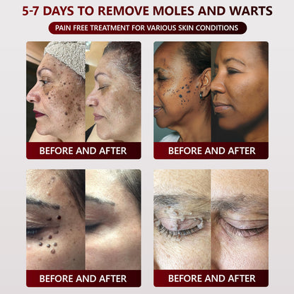 👑Dermatology Department Recommendation👑 Healrize® 𝐁𝐥𝗮𝐜𝐤 𝐑𝐢𝐜𝗲 𝐒𝐤𝗶𝐧 𝐑𝗲𝐩𝐚𝗶𝐫 𝐄𝐬𝐬𝗲𝐧𝐜𝐞 𝐂𝐫𝗲𝗮𝐦 ⚕️(𝗘𝗹𝗶𝗺𝗶𝗻𝗮𝘁𝗲𝘀 𝘄𝗮𝗿𝘁𝘀 𝗮𝗻𝗱 𝘀𝗸𝗶𝗻 𝘁𝗮𝗴𝘀, 𝗿𝗲𝗹𝗶𝗲𝘃𝗲𝘀 𝗽𝘀𝗼𝗿𝗶𝗮𝘀𝗶𝘀, 𝗶𝗺𝗽𝗿𝗼𝘃𝗲𝘀 𝗸𝗲𝗿𝗮𝘁𝗶𝗻 𝗯𝘂𝗶𝗹𝗱-𝘂𝗽 𝗮𝗻𝗱 𝗳𝗼𝗹𝗹𝗶𝗰𝘂𝗹𝗮𝗿 𝗸𝗲𝗿𝗮𝘁𝗶𝗻𝗶𝘇𝗮𝘁𝗶𝗼𝗻, 𝗳𝗮𝗱𝗲𝘀 𝗽𝗶𝗴𝗺𝗲𝗻𝘁𝗮𝘁𝗶𝗼𝗻, 𝘀𝘂𝗻 𝘀𝗽𝗼𝘁𝘀 & 𝗮𝗴𝗲 𝘀𝗽𝗼𝘁𝘀)