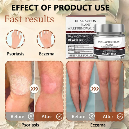 👑Dermatology Department Recommendation👑 Healrize® 𝐁𝐥𝗮𝐜𝐤 𝐑𝐢𝐜𝗲 𝐒𝐤𝗶𝐧 𝐑𝗲𝐩𝐚𝗶𝐫 𝐄𝐬𝐬𝗲𝐧𝐜𝐞 𝐂𝐫𝗲𝗮𝐦 ⚕️(𝗘𝗹𝗶𝗺𝗶𝗻𝗮𝘁𝗲𝘀 𝘄𝗮𝗿𝘁𝘀 𝗮𝗻𝗱 𝘀𝗸𝗶𝗻 𝘁𝗮𝗴𝘀, 𝗿𝗲𝗹𝗶𝗲𝘃𝗲𝘀 𝗽𝘀𝗼𝗿𝗶𝗮𝘀𝗶𝘀, 𝗶𝗺𝗽𝗿𝗼𝘃𝗲𝘀 𝗸𝗲𝗿𝗮𝘁𝗶𝗻 𝗯𝘂𝗶𝗹𝗱-𝘂𝗽 𝗮𝗻𝗱 𝗳𝗼𝗹𝗹𝗶𝗰𝘂𝗹𝗮𝗿 𝗸𝗲𝗿𝗮𝘁𝗶𝗻𝗶𝘇𝗮𝘁𝗶𝗼𝗻, 𝗳𝗮𝗱𝗲𝘀 𝗽𝗶𝗴𝗺𝗲𝗻𝘁𝗮𝘁𝗶𝗼𝗻, 𝘀𝘂𝗻 𝘀𝗽𝗼𝘁𝘀 & 𝗮𝗴𝗲 𝘀𝗽𝗼𝘁𝘀)