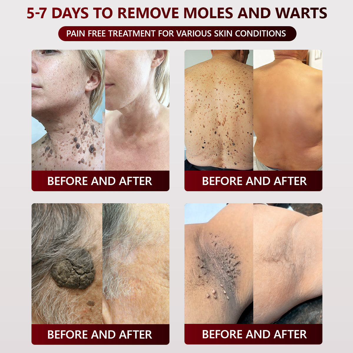 👑Dermatology Department Recommendation👑 Healrize® 𝐁𝐥𝗮𝐜𝐤 𝐑𝐢𝐜𝗲 𝐒𝐤𝗶𝐧 𝐑𝗲𝐩𝐚𝗶𝐫 𝐄𝐬𝐬𝗲𝐧𝐜𝐞 𝐂𝐫𝗲𝗮𝐦 ⚕️(𝗘𝗹𝗶𝗺𝗶𝗻𝗮𝘁𝗲𝘀 𝘄𝗮𝗿𝘁𝘀 𝗮𝗻𝗱 𝘀𝗸𝗶𝗻 𝘁𝗮𝗴𝘀, 𝗿𝗲𝗹𝗶𝗲𝘃𝗲𝘀 𝗽𝘀𝗼𝗿𝗶𝗮𝘀𝗶𝘀, 𝗶𝗺𝗽𝗿𝗼𝘃𝗲𝘀 𝗸𝗲𝗿𝗮𝘁𝗶𝗻 𝗯𝘂𝗶𝗹𝗱-𝘂𝗽 𝗮𝗻𝗱 𝗳𝗼𝗹𝗹𝗶𝗰𝘂𝗹𝗮𝗿 𝗸𝗲𝗿𝗮𝘁𝗶𝗻𝗶𝘇𝗮𝘁𝗶𝗼𝗻, 𝗳𝗮𝗱𝗲𝘀 𝗽𝗶𝗴𝗺𝗲𝗻𝘁𝗮𝘁𝗶𝗼𝗻, 𝘀𝘂𝗻 𝘀𝗽𝗼𝘁𝘀 & 𝗮𝗴𝗲 𝘀𝗽𝗼𝘁𝘀)