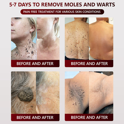 👑Dermatology Department Recommendation👑 Healrize® 𝐁𝐥𝗮𝐜𝐤 𝐑𝐢𝐜𝗲 𝐒𝐤𝗶𝐧 𝐑𝗲𝐩𝐚𝗶𝐫 𝐄𝐬𝐬𝗲𝐧𝐜𝐞 𝐂𝐫𝗲𝗮𝐦 ⚕️(𝗘𝗹𝗶𝗺𝗶𝗻𝗮𝘁𝗲𝘀 𝘄𝗮𝗿𝘁𝘀 𝗮𝗻𝗱 𝘀𝗸𝗶𝗻 𝘁𝗮𝗴𝘀, 𝗿𝗲𝗹𝗶𝗲𝘃𝗲𝘀 𝗽𝘀𝗼𝗿𝗶𝗮𝘀𝗶𝘀, 𝗶𝗺𝗽𝗿𝗼𝘃𝗲𝘀 𝗸𝗲𝗿𝗮𝘁𝗶𝗻 𝗯𝘂𝗶𝗹𝗱-𝘂𝗽 𝗮𝗻𝗱 𝗳𝗼𝗹𝗹𝗶𝗰𝘂𝗹𝗮𝗿 𝗸𝗲𝗿𝗮𝘁𝗶𝗻𝗶𝘇𝗮𝘁𝗶𝗼𝗻, 𝗳𝗮𝗱𝗲𝘀 𝗽𝗶𝗴𝗺𝗲𝗻𝘁𝗮𝘁𝗶𝗼𝗻, 𝘀𝘂𝗻 𝘀𝗽𝗼𝘁𝘀 & 𝗮𝗴𝗲 𝘀𝗽𝗼𝘁𝘀)