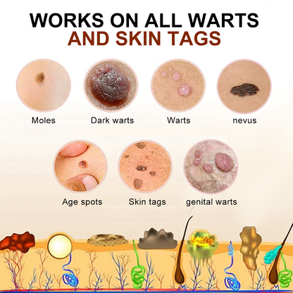 👑Dermatology Department Recommendation👑 Healrize® 𝐁𝐥𝗮𝐜𝐤 𝐑𝐢𝐜𝗲 𝐒𝐤𝗶𝐧 𝐑𝗲𝐩𝐚𝗶𝐫 𝐄𝐬𝐬𝗲𝐧𝐜𝐞 𝐂𝐫𝗲𝗮𝐦 ⚕️(𝗘𝗹𝗶𝗺𝗶𝗻𝗮𝘁𝗲𝘀 𝘄𝗮𝗿𝘁𝘀 𝗮𝗻𝗱 𝘀𝗸𝗶𝗻 𝘁𝗮𝗴𝘀, 𝗿𝗲𝗹𝗶𝗲𝘃𝗲𝘀 𝗽𝘀𝗼𝗿𝗶𝗮𝘀𝗶𝘀, 𝗶𝗺𝗽𝗿𝗼𝘃𝗲𝘀 𝗸𝗲𝗿𝗮𝘁𝗶𝗻 𝗯𝘂𝗶𝗹𝗱-𝘂𝗽 𝗮𝗻𝗱 𝗳𝗼𝗹𝗹𝗶𝗰𝘂𝗹𝗮𝗿 𝗸𝗲𝗿𝗮𝘁𝗶𝗻𝗶𝘇𝗮𝘁𝗶𝗼𝗻, 𝗳𝗮𝗱𝗲𝘀 𝗽𝗶𝗴𝗺𝗲𝗻𝘁𝗮𝘁𝗶𝗼𝗻, 𝘀𝘂𝗻 𝘀𝗽𝗼𝘁𝘀 & 𝗮𝗴𝗲 𝘀𝗽𝗼𝘁𝘀)