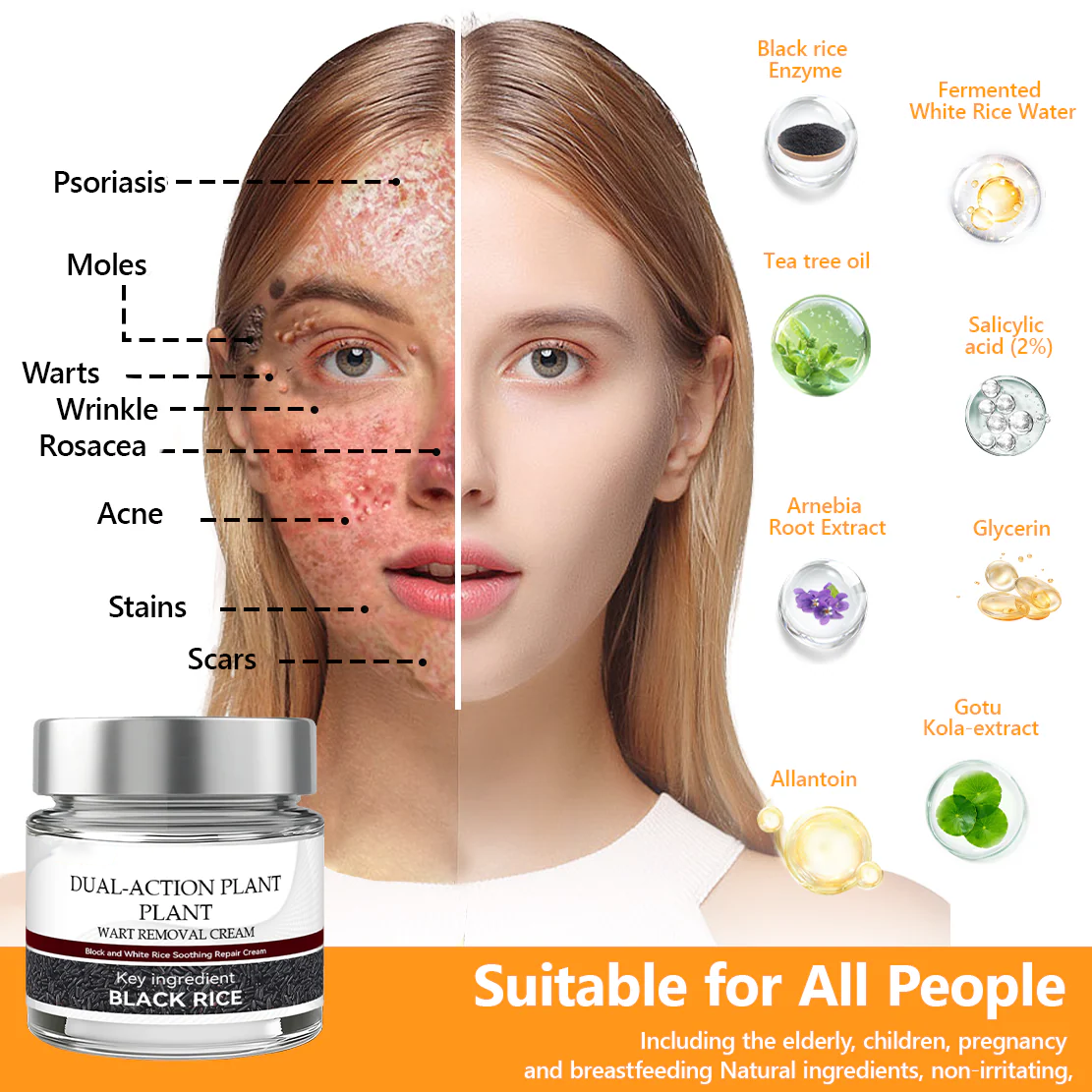 👑Dermatology Department Recommendation👑 Healrize® 𝐁𝐥𝗮𝐜𝐤 𝐑𝐢𝐜𝗲 𝐒𝐤𝗶𝐧 𝐑𝗲𝐩𝐚𝗶𝐫 𝐄𝐬𝐬𝗲𝐧𝐜𝐞 𝐂𝐫𝗲𝗮𝐦 ⚕️(𝗘𝗹𝗶𝗺𝗶𝗻𝗮𝘁𝗲𝘀 𝘄𝗮𝗿𝘁𝘀 𝗮𝗻𝗱 𝘀𝗸𝗶𝗻 𝘁𝗮𝗴𝘀, 𝗿𝗲𝗹𝗶𝗲𝘃𝗲𝘀 𝗽𝘀𝗼𝗿𝗶𝗮𝘀𝗶𝘀, 𝗶𝗺𝗽𝗿𝗼𝘃𝗲𝘀 𝗸𝗲𝗿𝗮𝘁𝗶𝗻 𝗯𝘂𝗶𝗹𝗱-𝘂𝗽 𝗮𝗻𝗱 𝗳𝗼𝗹𝗹𝗶𝗰𝘂𝗹𝗮𝗿 𝗸𝗲𝗿𝗮𝘁𝗶𝗻𝗶𝘇𝗮𝘁𝗶𝗼𝗻, 𝗳𝗮𝗱𝗲𝘀 𝗽𝗶𝗴𝗺𝗲𝗻𝘁𝗮𝘁𝗶𝗼𝗻, 𝘀𝘂𝗻 𝘀𝗽𝗼𝘁𝘀 & 𝗮𝗴𝗲 𝘀𝗽𝗼𝘁𝘀)